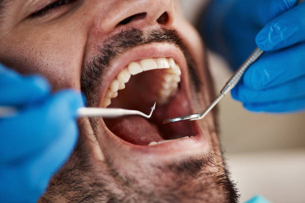 Best Walk-In Emergency Dentist in Cassville, WV