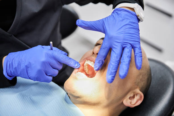 Best Emergency Wisdom Teeth Removal in Cassville, WV