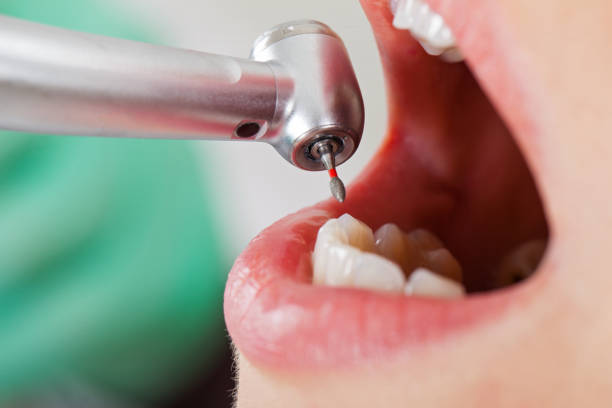 Best Emergency Orthodontic Repairs in Cassville, WV
